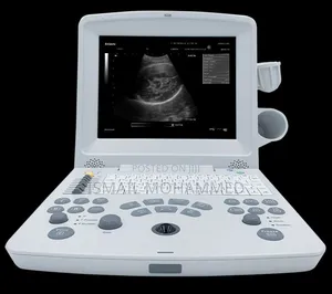 EDAN DUS60 Ultrasound Machine With Two Probes