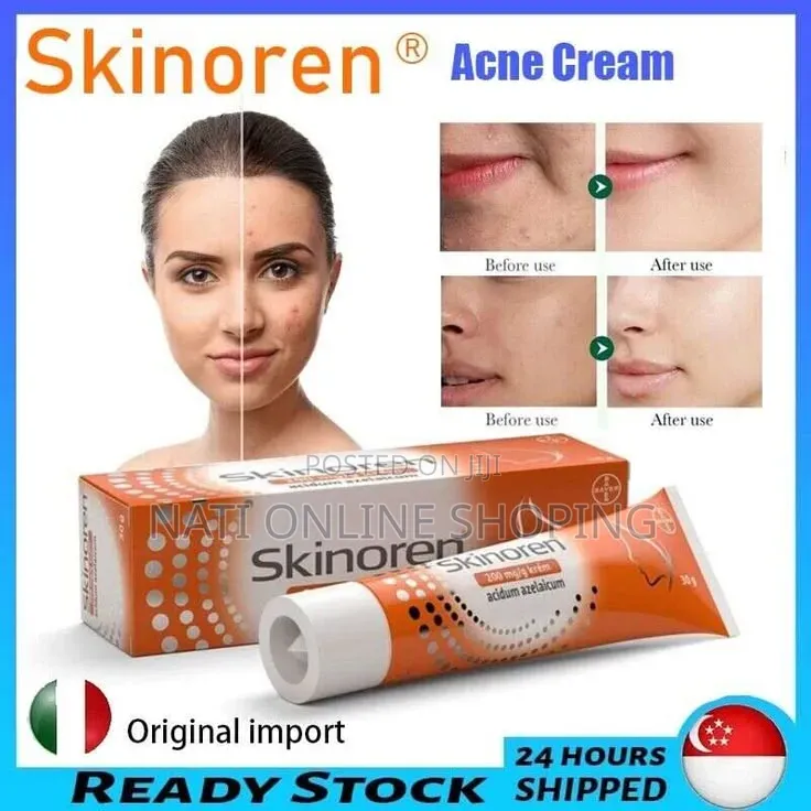 Skinoren Cream (20% Azelaic Acid)