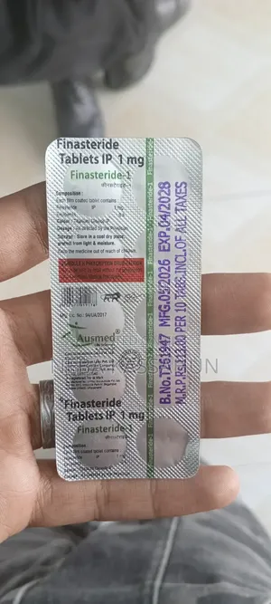 Finastride 1mg and 5 Mg for Hair Loss
