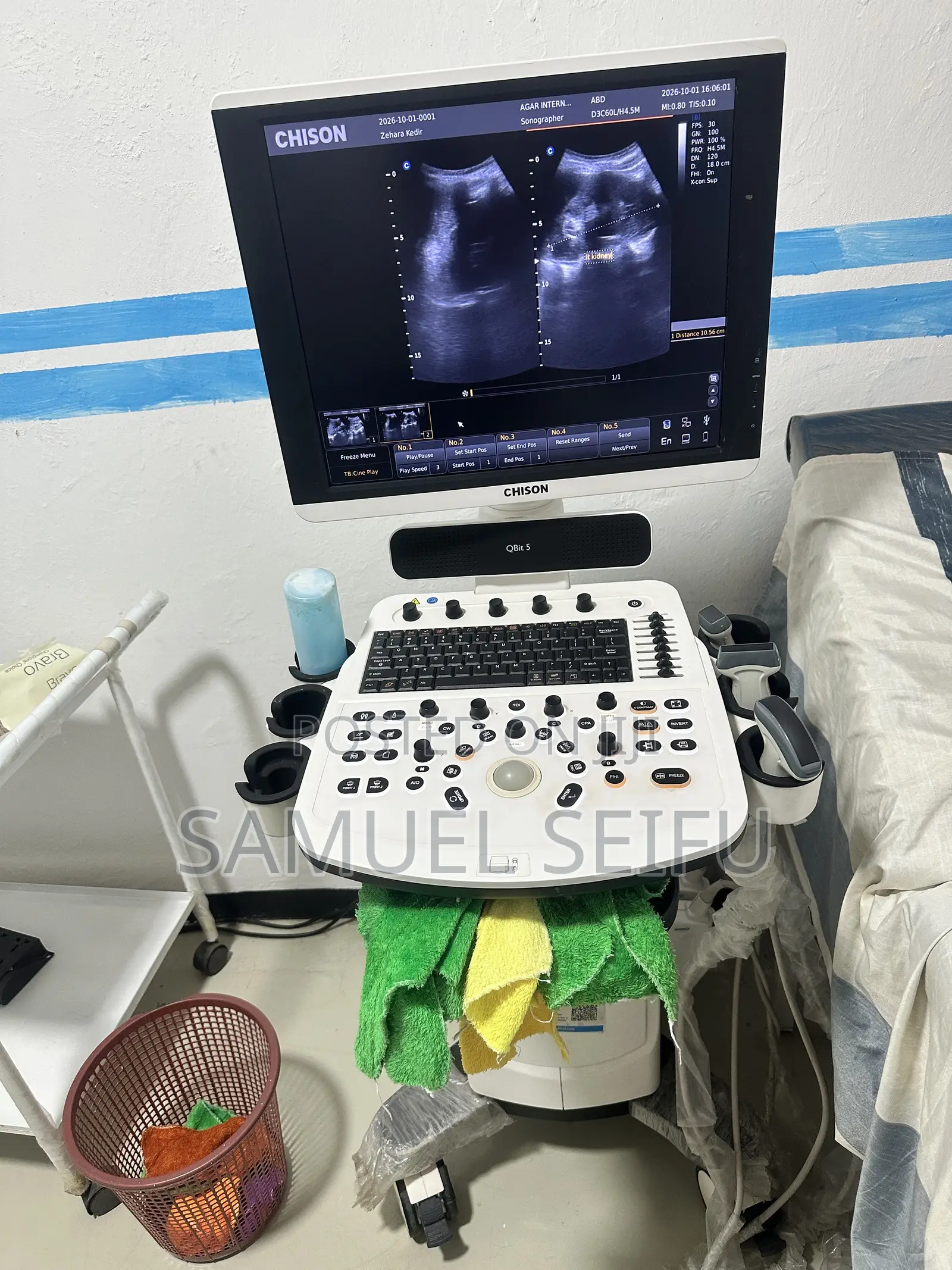 Chison Qbit 5 Color Doppler Ultrasound