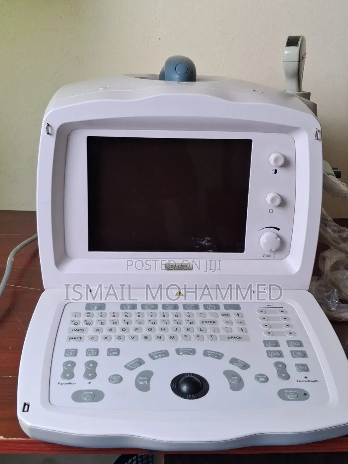 Tenshe Geza Yesra Ultrasound Code 1