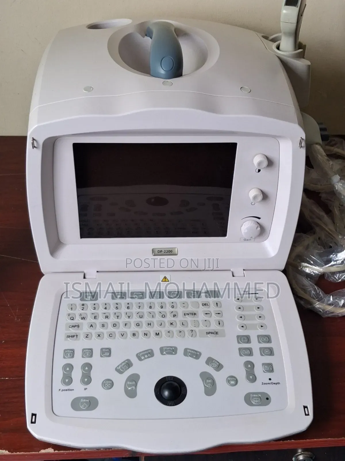 Tenshe Geza Yesra Ultrasound Code 1