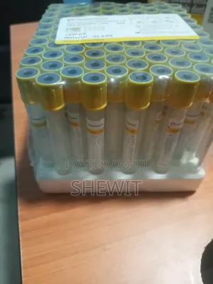 Test Tube (SST)