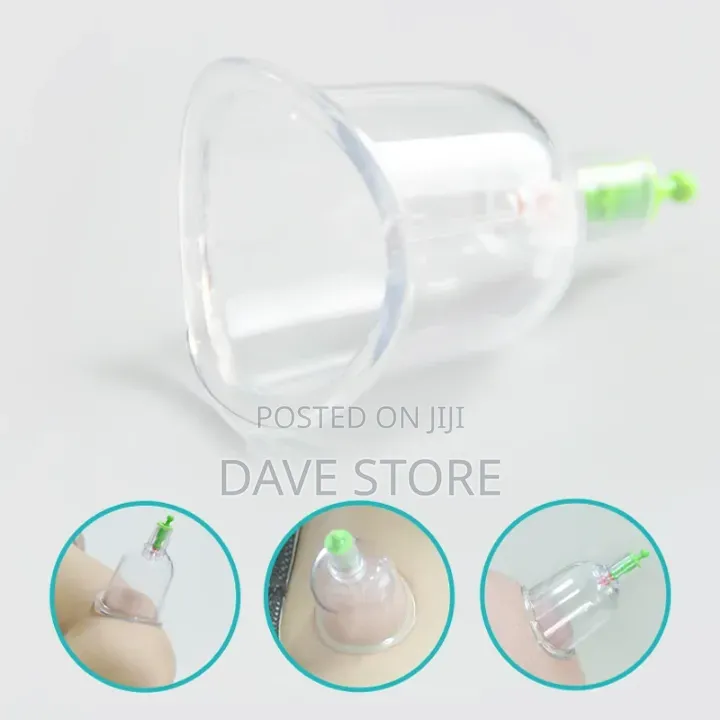 Healthy Body Cupping Set