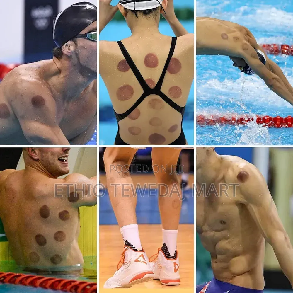 18Pcs Sterilized Suction Cupping Terapy ዋግምት