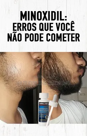 Kirkland Signature Minoxidil 5% Topical Solution
