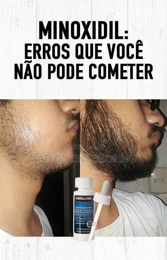 Kirkland Signature Minoxidil 5% Topical Solution