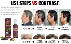 Sol Lora Herbal Gray Hair Verse Essence የሽበት ማጥፊያ እና የፀጉር መንከባከቢያ