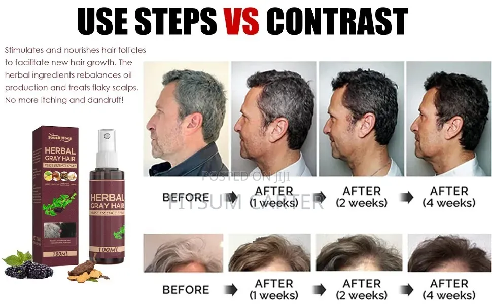 Sol Lora Herbal Gray Hair Verse Essence የሽበት ማጥፊያ እና የፀጉር መንከባከቢያ