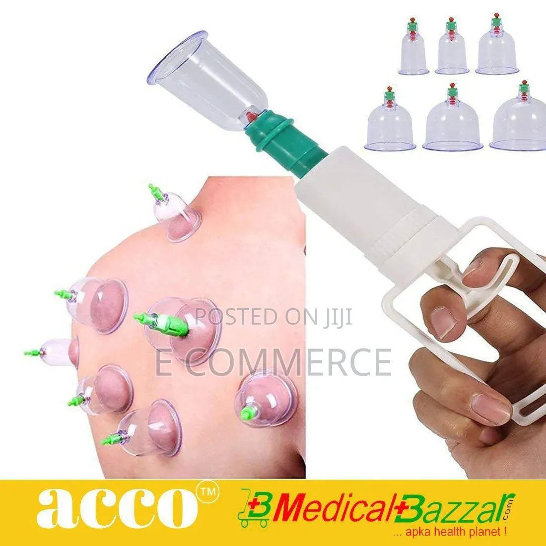 18 Cups Bio Magnetic Cupping Set