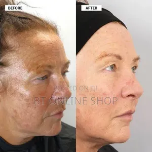 Dr v Facial Pigmentation Kit