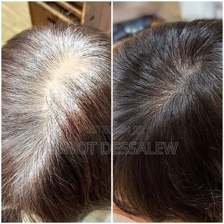 Grey Hair Wand ሽበት ማጥፊያ
