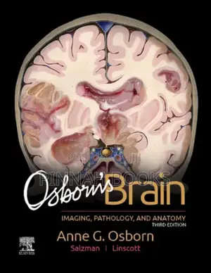 Osborn's Brain: Imaging, Pathology, & Anatomy 3rd Ed by Anne G. Osborn