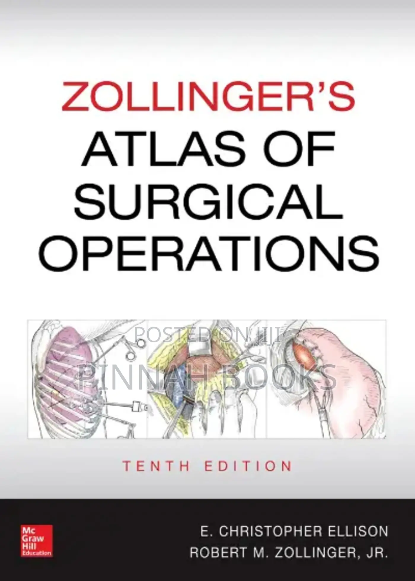 Zollinger’s Atlas of Surgical Operation Christopher E & R. Zollinger J