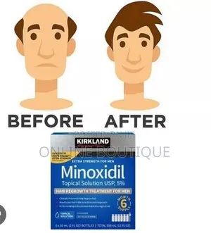 Minoxidil 5% Foam