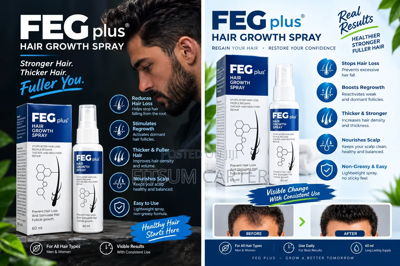 FEG Plus Hair Growth Spray 60 Ml