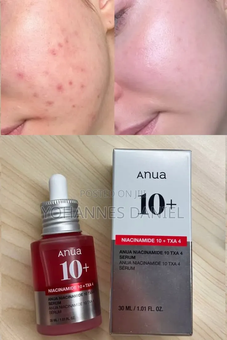 Anua Niacinamide Serum – Niacinamide & Tranexamic Acid