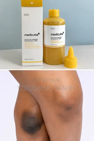 Medicube Kojic Acid Toner – Dark Spot Care Facial Toner