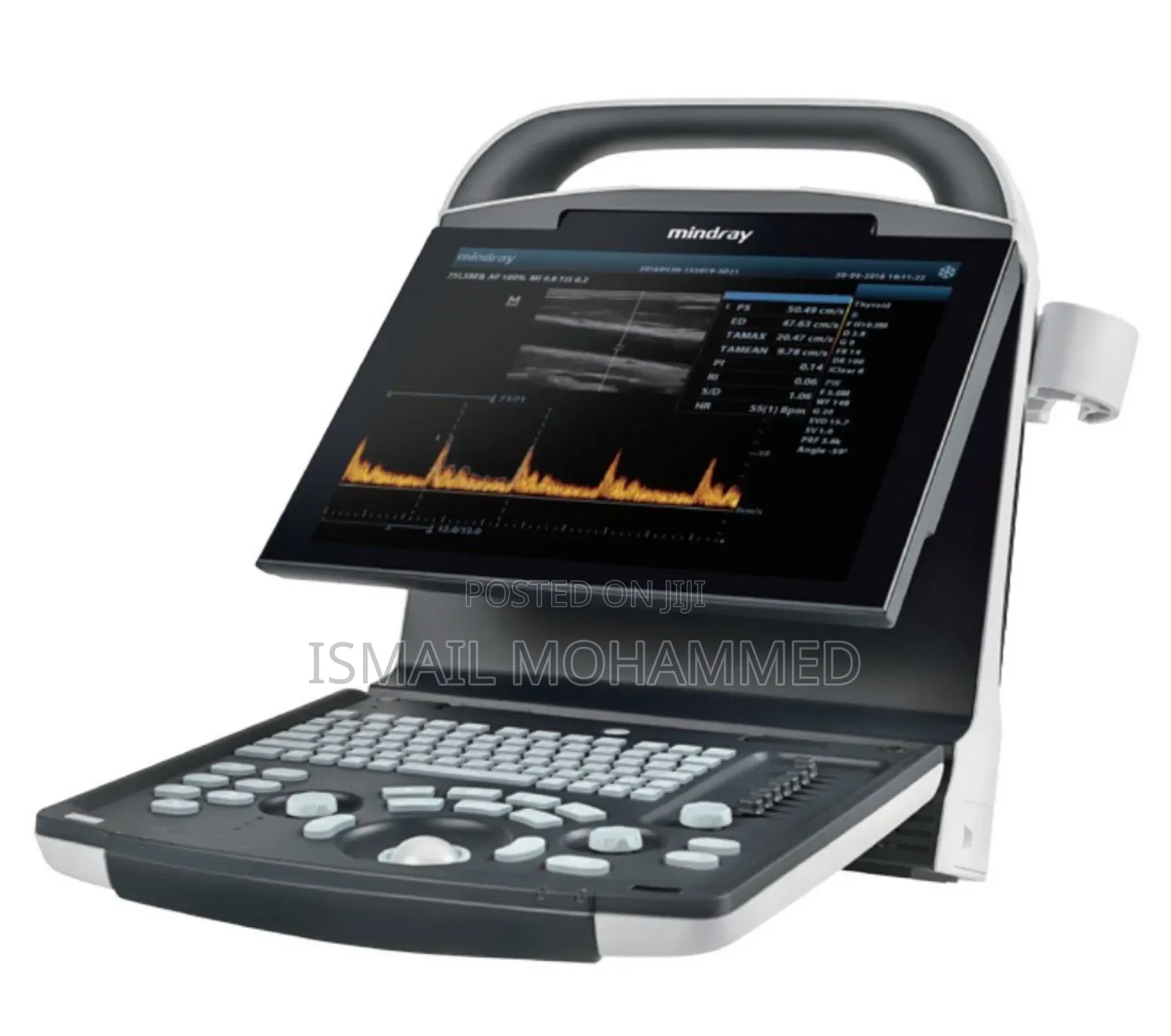 New Mindray Dp 18 Ultrasound Code 5