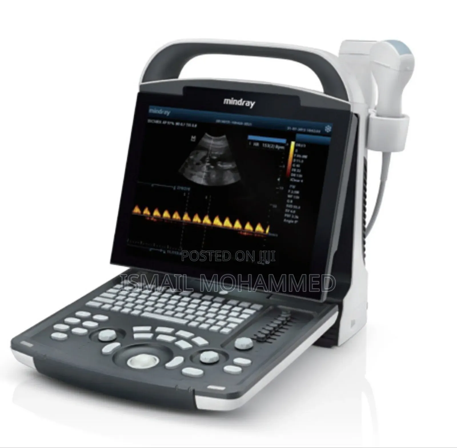 New Mindray Dp 18 Ultrasound Code 5