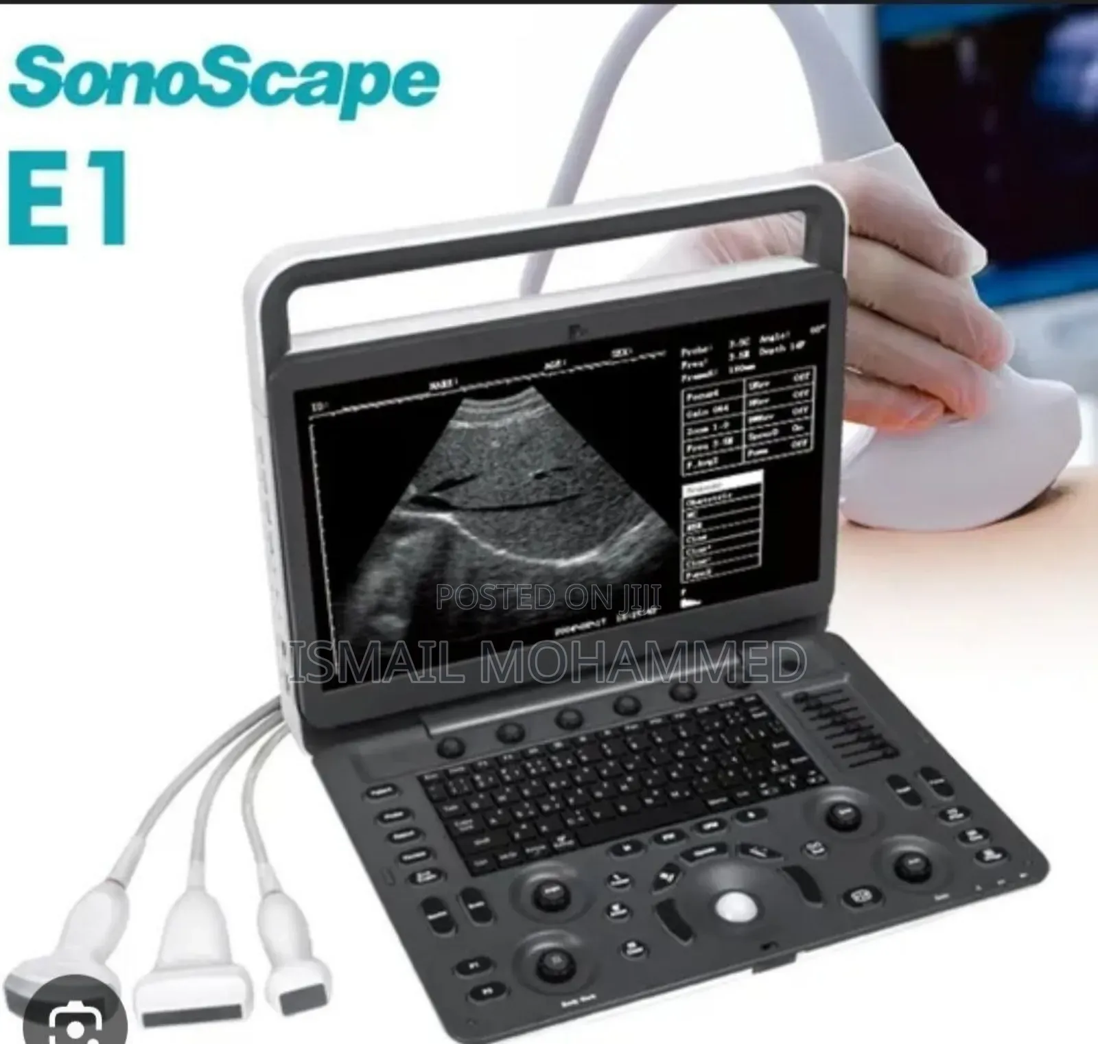 SonoScape E1 Ultrasound Machine Code 13