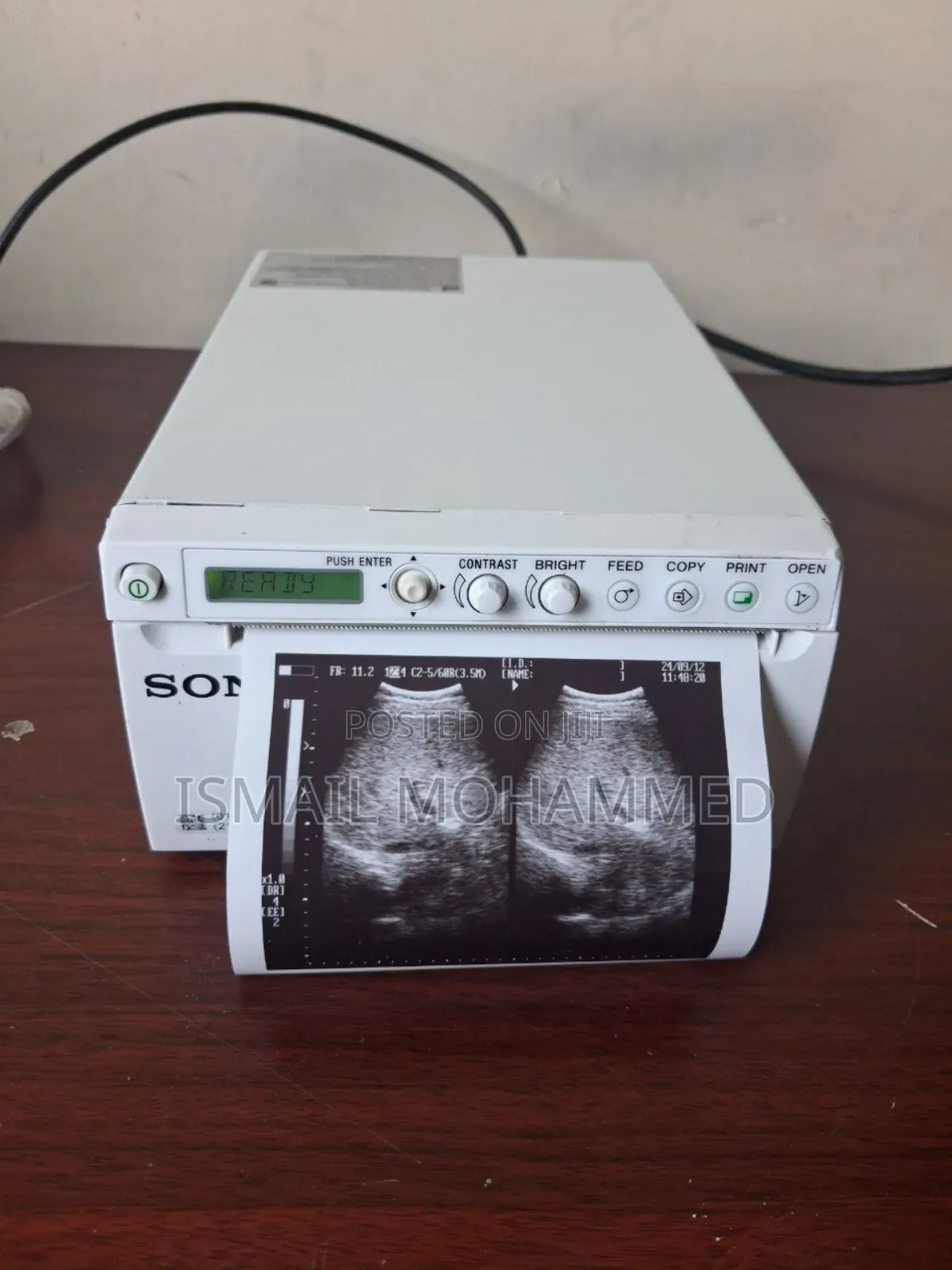 Sony Hybrid Ultrasound Printer Code 25