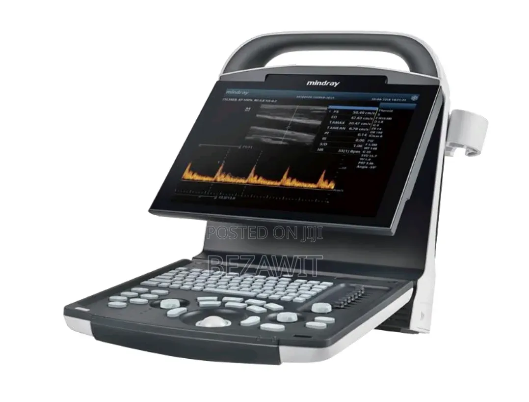 Mindray Dp-15 Ultrasound With Two Prob