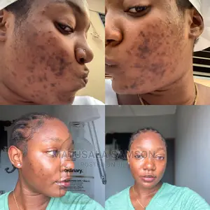 The Ordinary Niacinamide