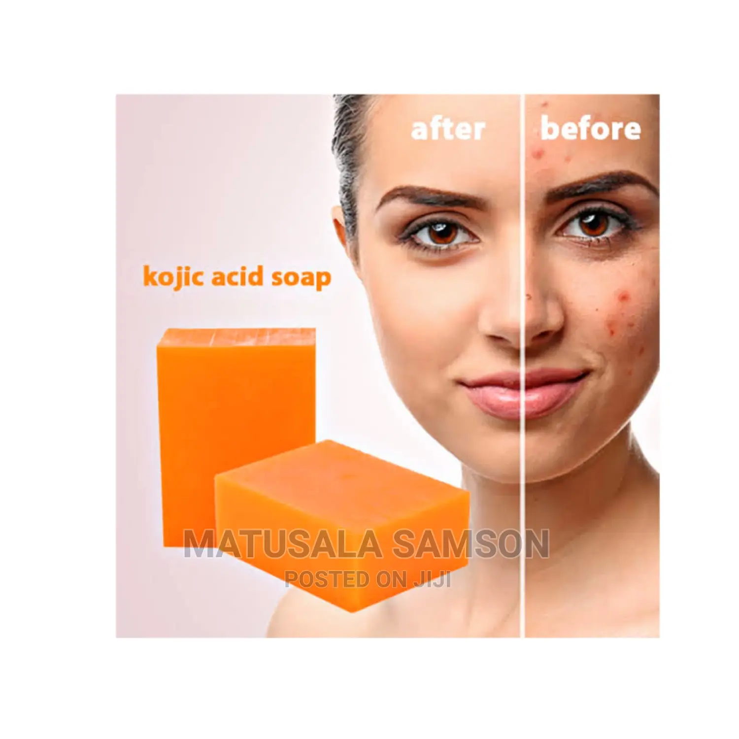 Kojic San Soap