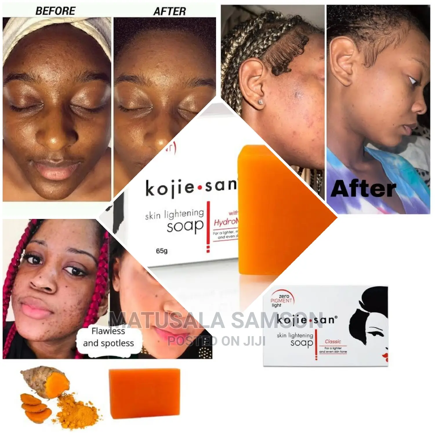 Kojic San Soap