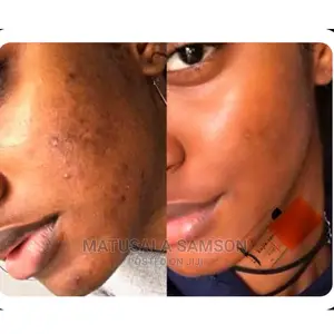 Kojic San Soap