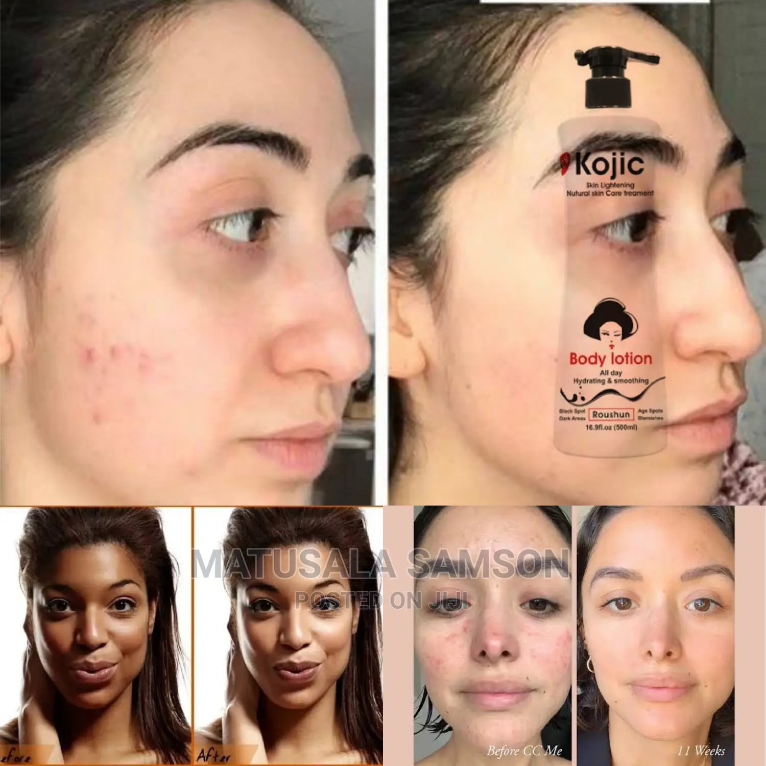 Kojic Lotion