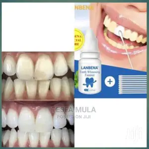 Photo - Lanbena Teeth ጥርስ ያፀዳል