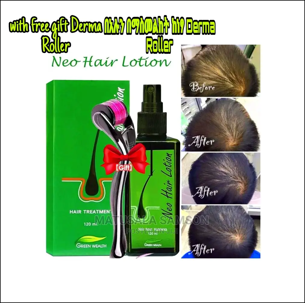 Neo Hair Lotion +Derma Roller Gift