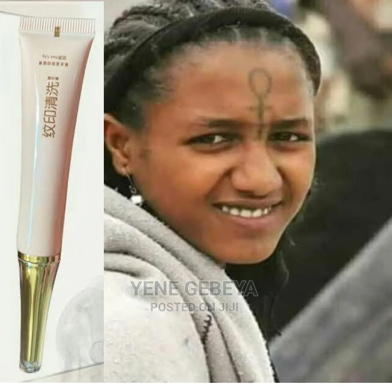 የንቅሳት ማጥፊያ ጄል