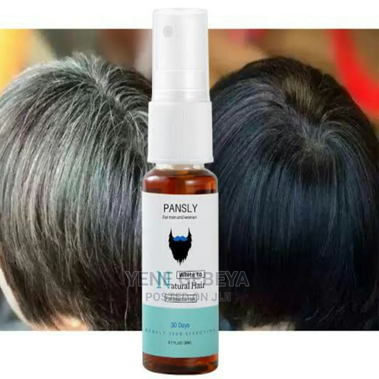 ሽበትን ለዘላቂነት ማጥፊያ ቅባት