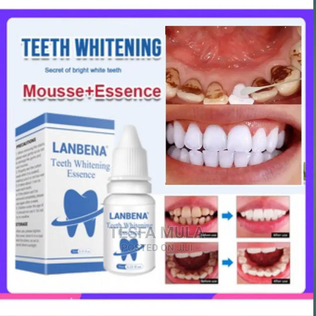 Lanbena Teeth ጥርስ ያነፃል