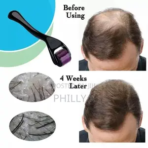 Derma Roller System
