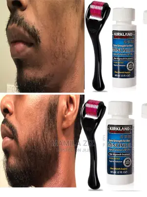 Minoxidil Derma Roller