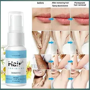 Photo - Pansly ፀጉር ያጠፋል