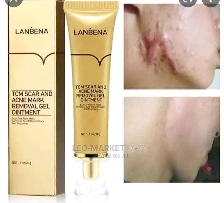 TCM Scar and Acne Mask Removal Gel Ointment