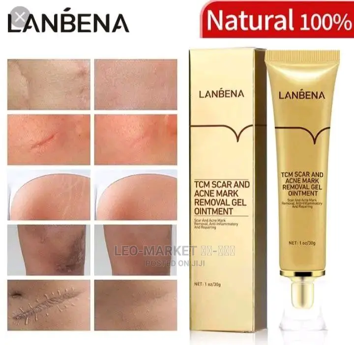 TCM Scar and Acne Mask Removal Gel Ointment