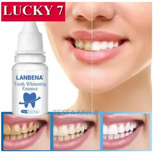 Photo - Whiting ለነጭ ጥርስ