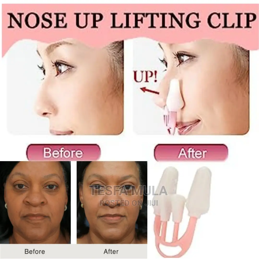 ለተደፈጠጠ ለተጣመመ አፍንጫ