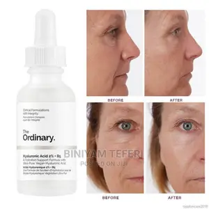 Hyaluronic Acid 2%+B5