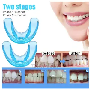 Photo - ለተዘረዘረ የጥርስ ብሬስ