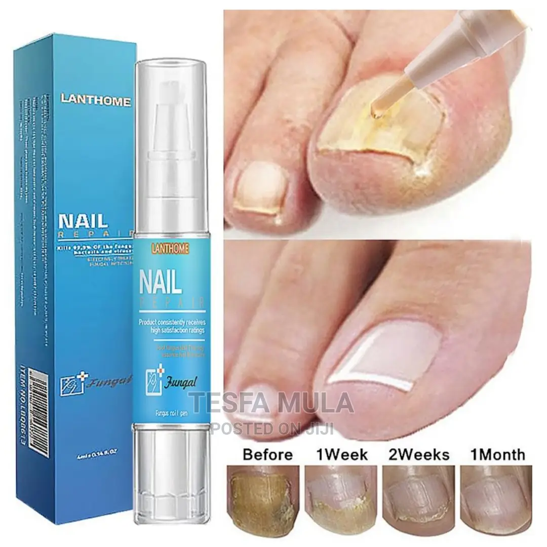 ጥፍር ለሌለው ማሳደጊያ