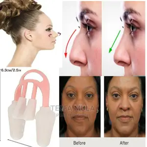 Photo - ለሰልካካ አፍንጫ ያደርጋል