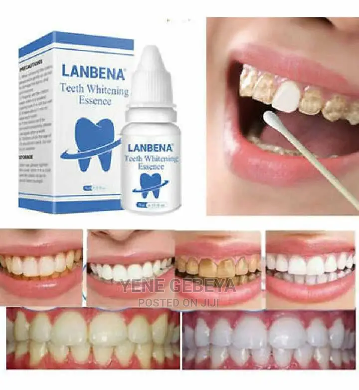 Lanbena Teeth Whitening