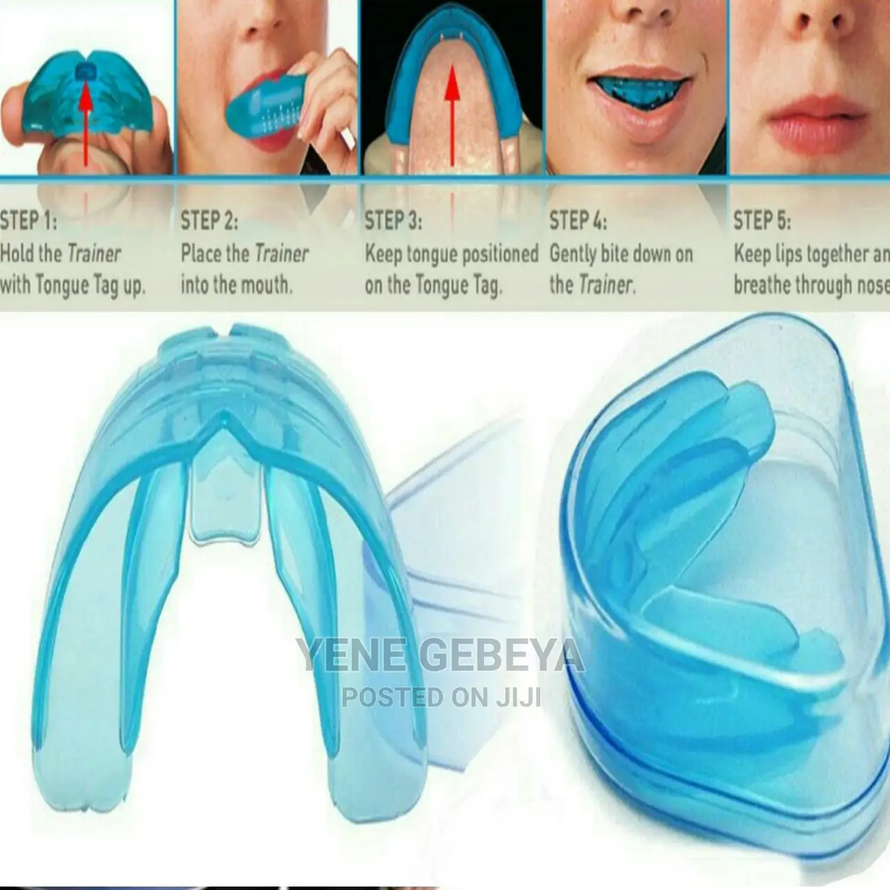 የጥርስ ማስተካከያ